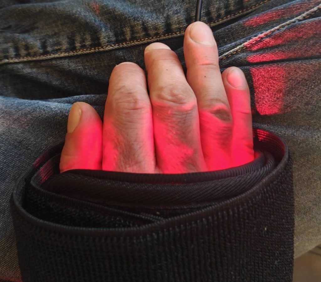 A hand in the H.E.D. Office under red 660 nm and 850 nm infrared light during recovery. / Ruka u H.E.D. Office-u pod crvenim infracrvenim svetlom od 660 nm i 850 nm tokom oporavka.